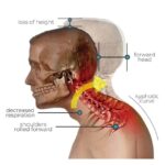 DIY Pain Relief Cervical & Thoracic Stretcher
