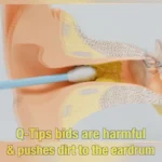 Innovative Design Ear Wax Cleaner Tool Set