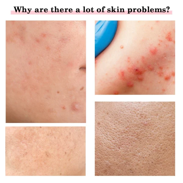 Se3a1c9f13c77454bb9f0155e075c40cbj Multi-functional Facial Skin Care Massager Electric Device Clean Face Skin Rejuvenation Lifting Tighten